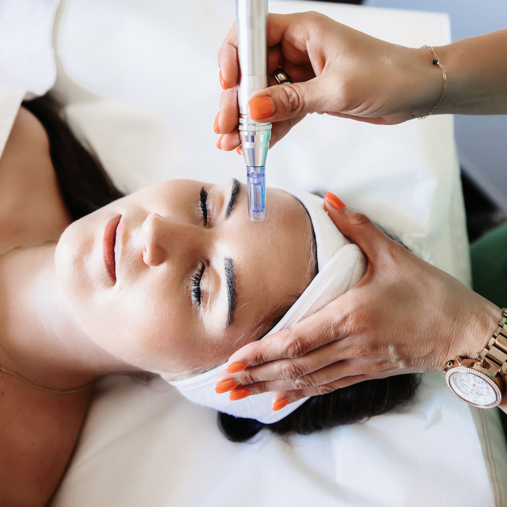 Das Bild zeigt eine MicroNeedling Anwendung bei Dr. Hinrichs Köln.